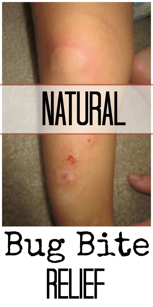 Natural Bug Bite Relief